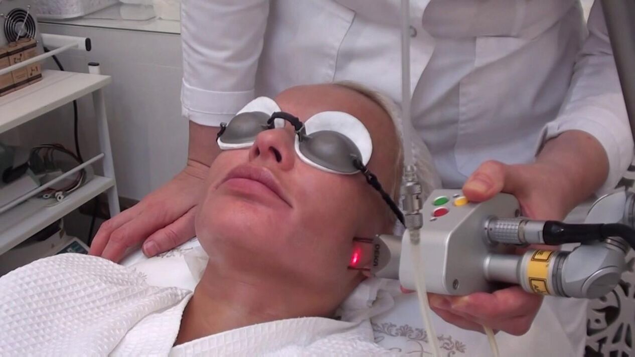 Laser treatment of problem areas of the facial skin