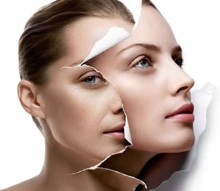 rejuvenation of facial skin